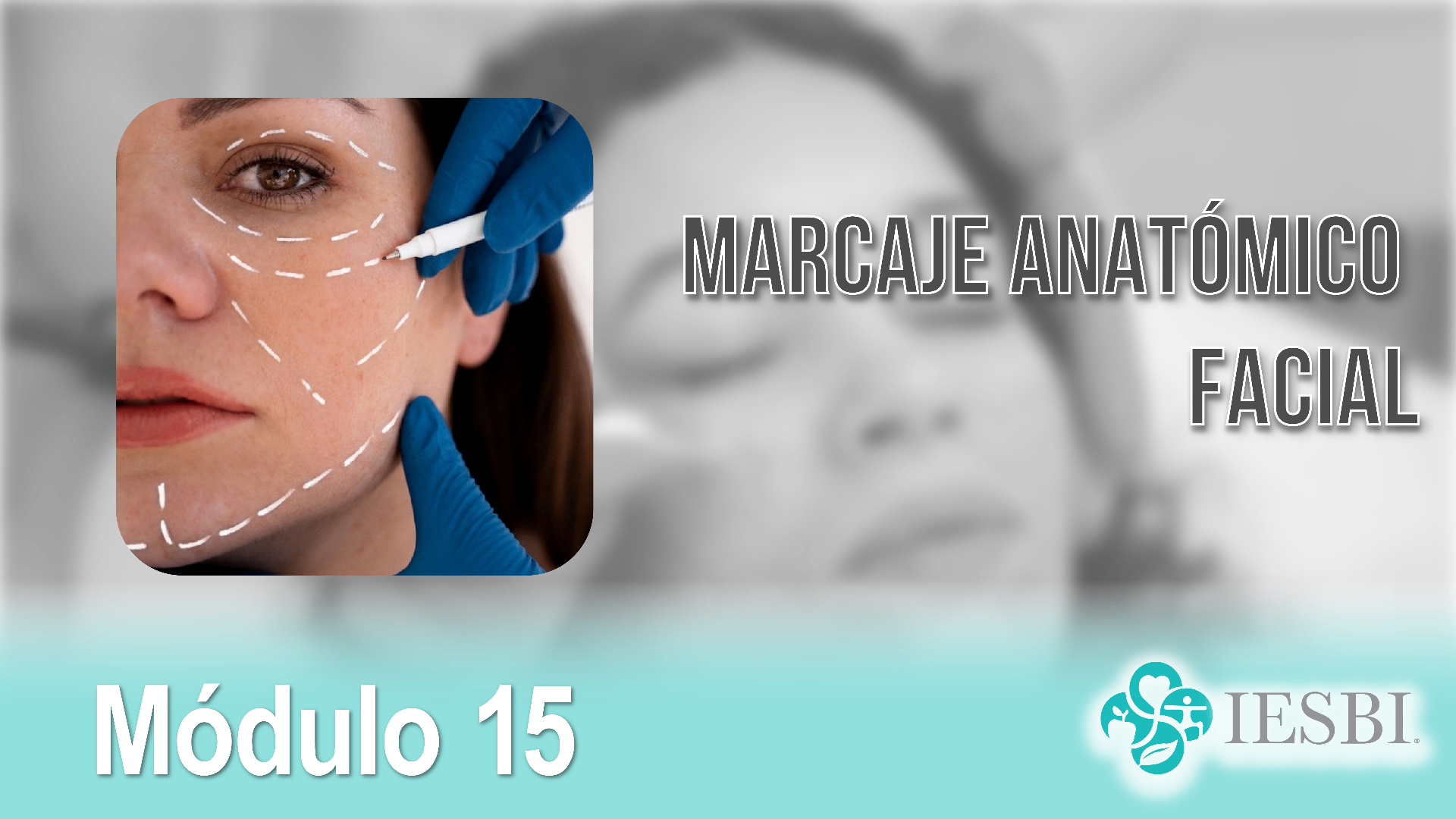 Módulo 15: Marcaje Anatómico facial