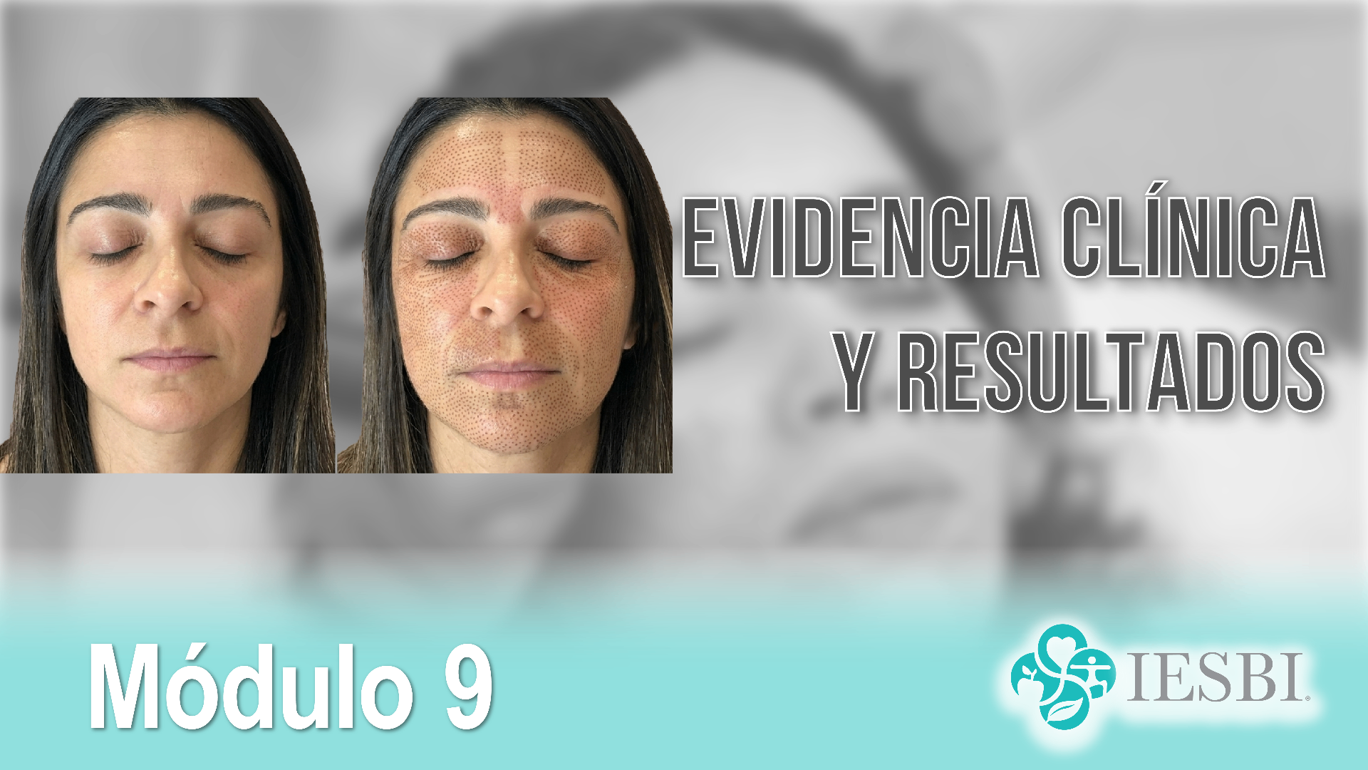 Módulo 09: Evidencia Clínica y Resultados del Plasma Pen