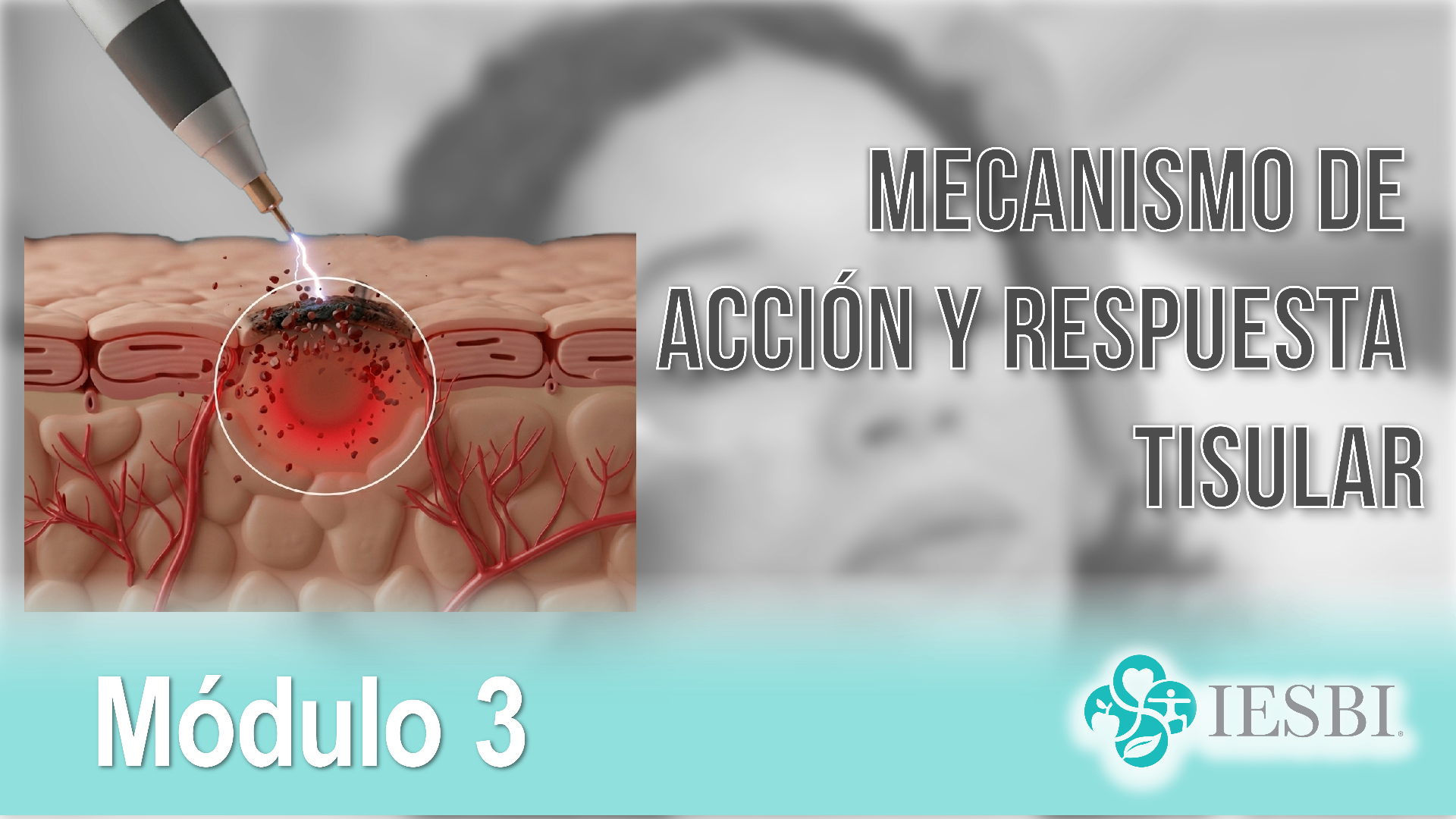 Módulo 03: Mecanismo de Acción y Respuesta Tisular