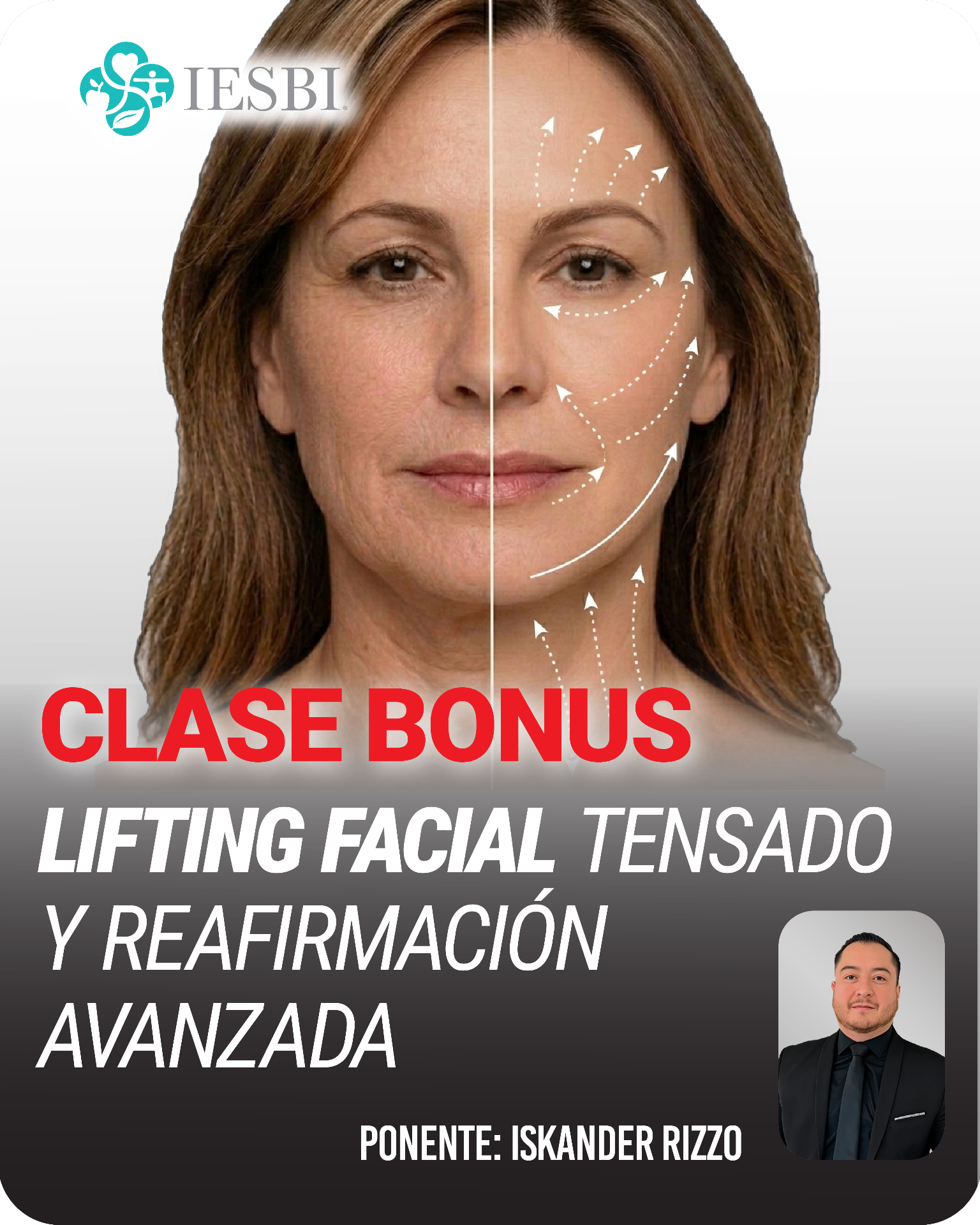 Lifting facial: Tensado y reafirmación avanzada