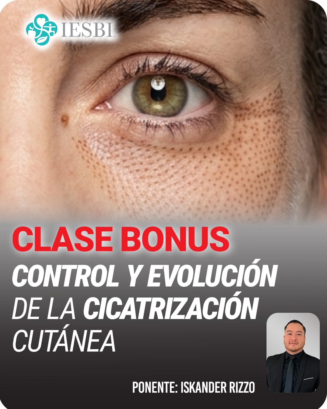 Control y Evolución de la Cicatrización Cutánea